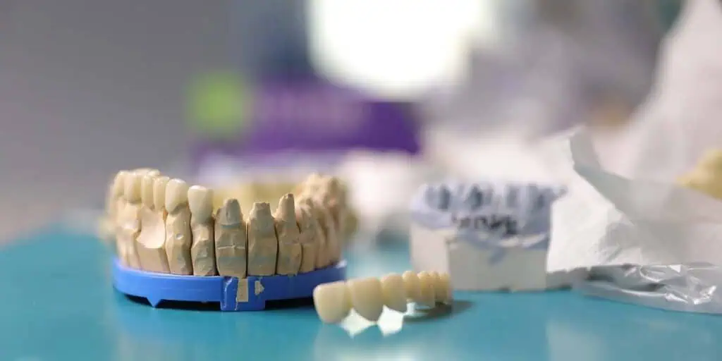 „Nyelvlökéses nyelés”, mit jelent ez a kifejezés?